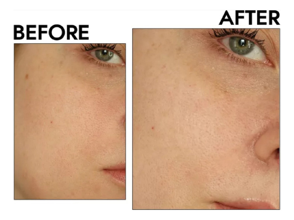 Extracto Natural Cosmetico Astrin Therapy Plus 6 25ml - Imagen 3