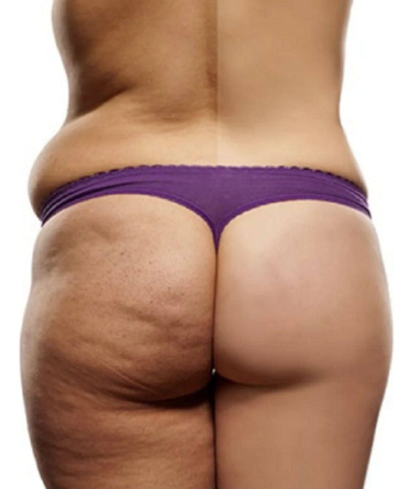 Extracto Natural Cosmetico 500ml Slim Therapy 8 - Imagen 3